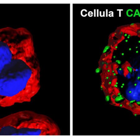 Arriva in Europa la Car-T, la prima terapia personalizzata contro il cancro
